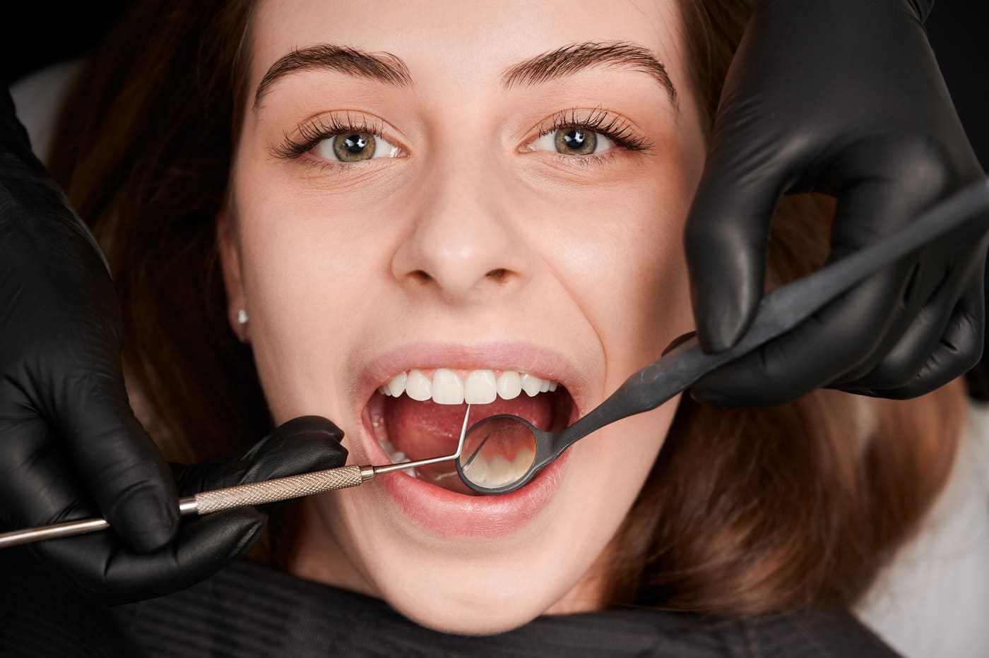dentist-hands-sterile-gloves-examining-woman-teeth