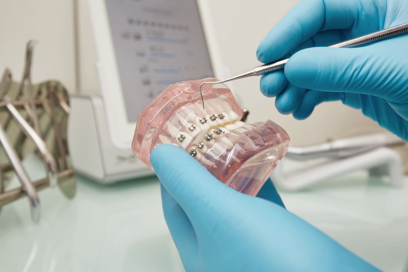 dentist-holding-dental-plastic-model-with-braces