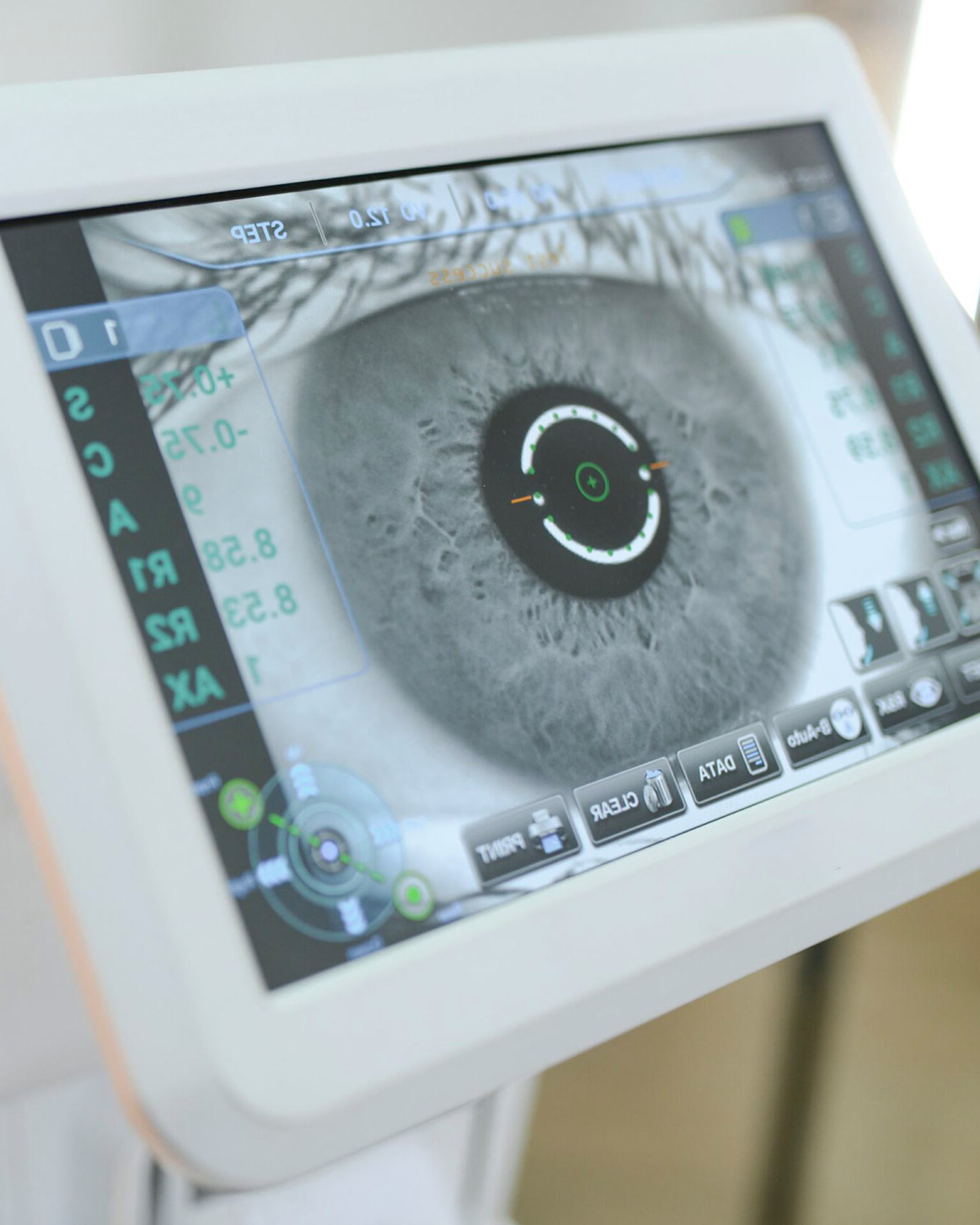 esame-glaucoma-selvini